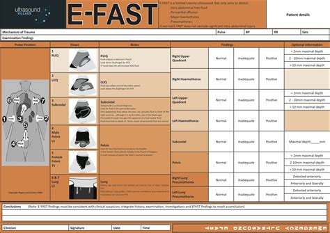 efast database.